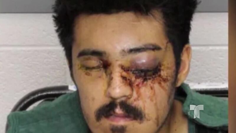 Elías Bustamente le disparó a su víctima 3 veces