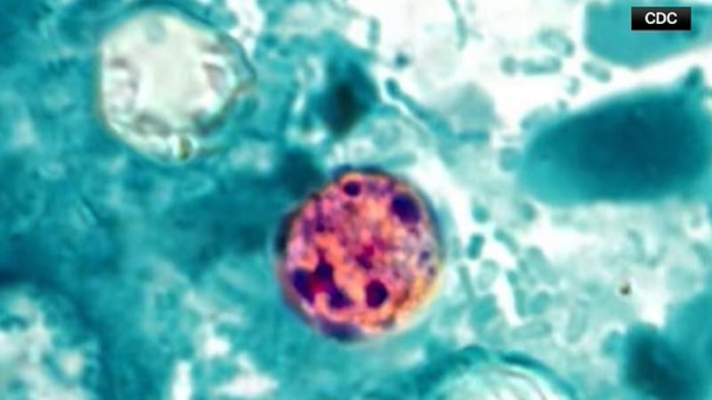 Cyclosporiasis