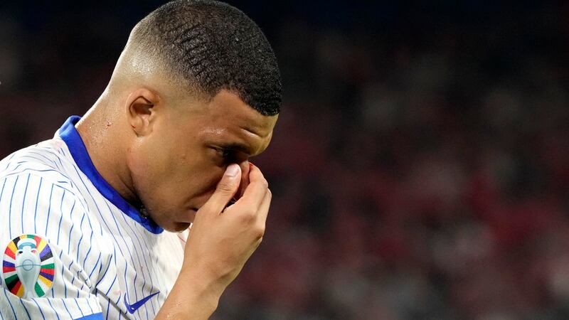 “¿Ideas de máscaras?”. Mbappé se toma con humor la fractura de la nariz