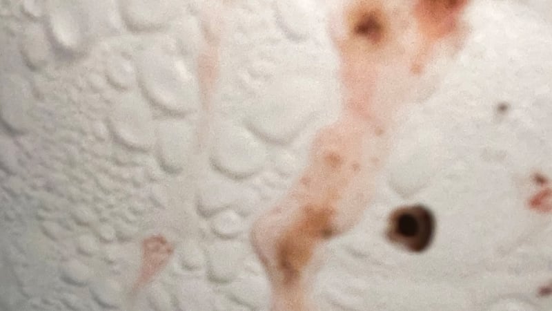 Un inspector de salud del condado de Gwinnett fotografió infracciones sanitarias críticas...