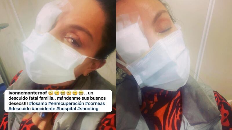 Un “descuido fatal” envió a la querida Ivonne Montero a emergencias por una quemadura en sus...
