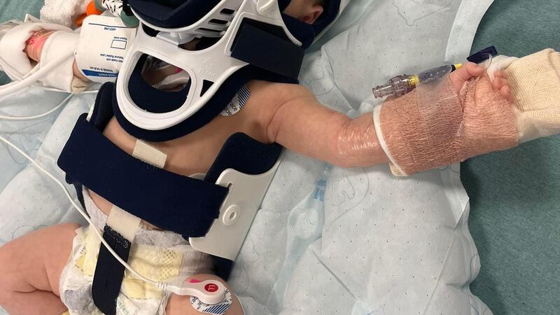 Georgia Prestwood fue tratada en el Brenner Children's Hospital en Winston-Salem por una...
