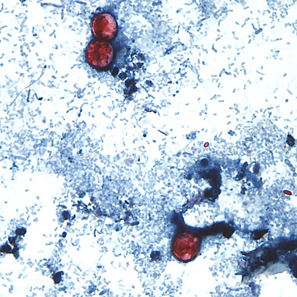 En esta imagen sin fecha, tomada a través de un microscopio y proporcionada por los Centros...