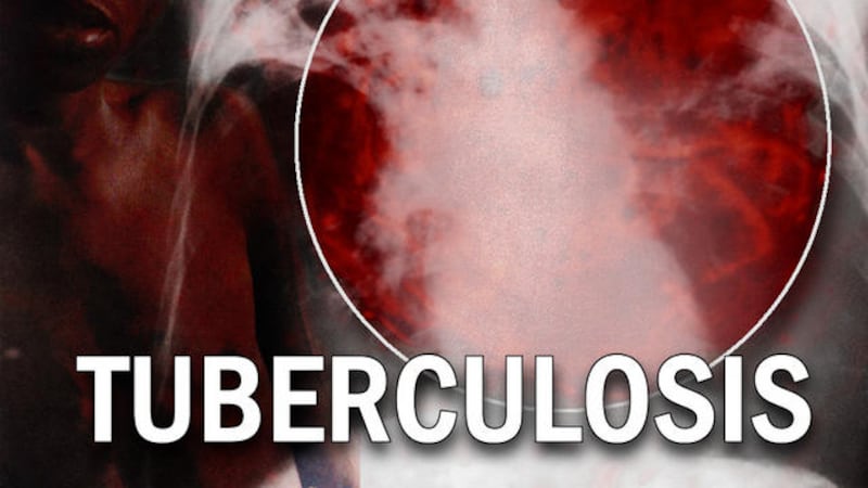 casos de tuberculosis en estados unidos