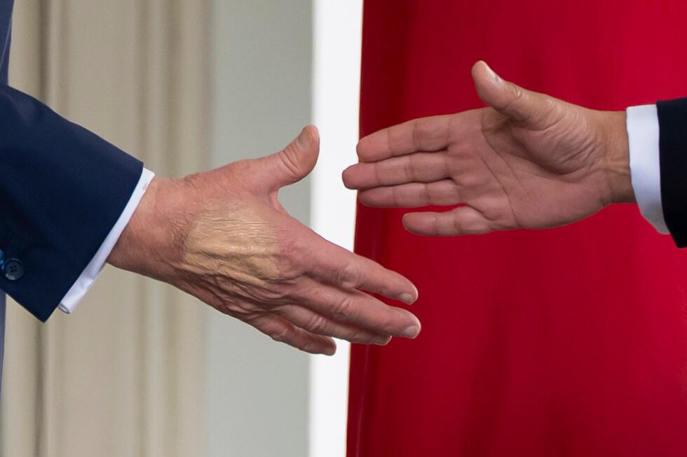 Diagnostican a Trump con “insuficiencia venosa crónica” tras revisión por hinchazón en las...