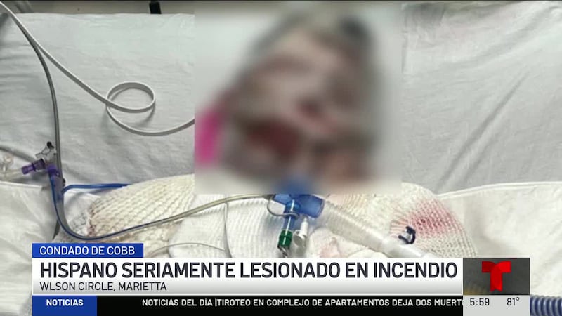 Un hispano de Cobb resultó seriamente herido tras sufrir quemaduras cuando buscaba a los hijos...