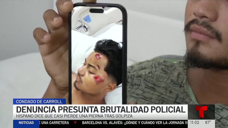 Ángel Maldonado dice que un agente le aplicó la pistola taser y luego lo golpeó repetidamente...